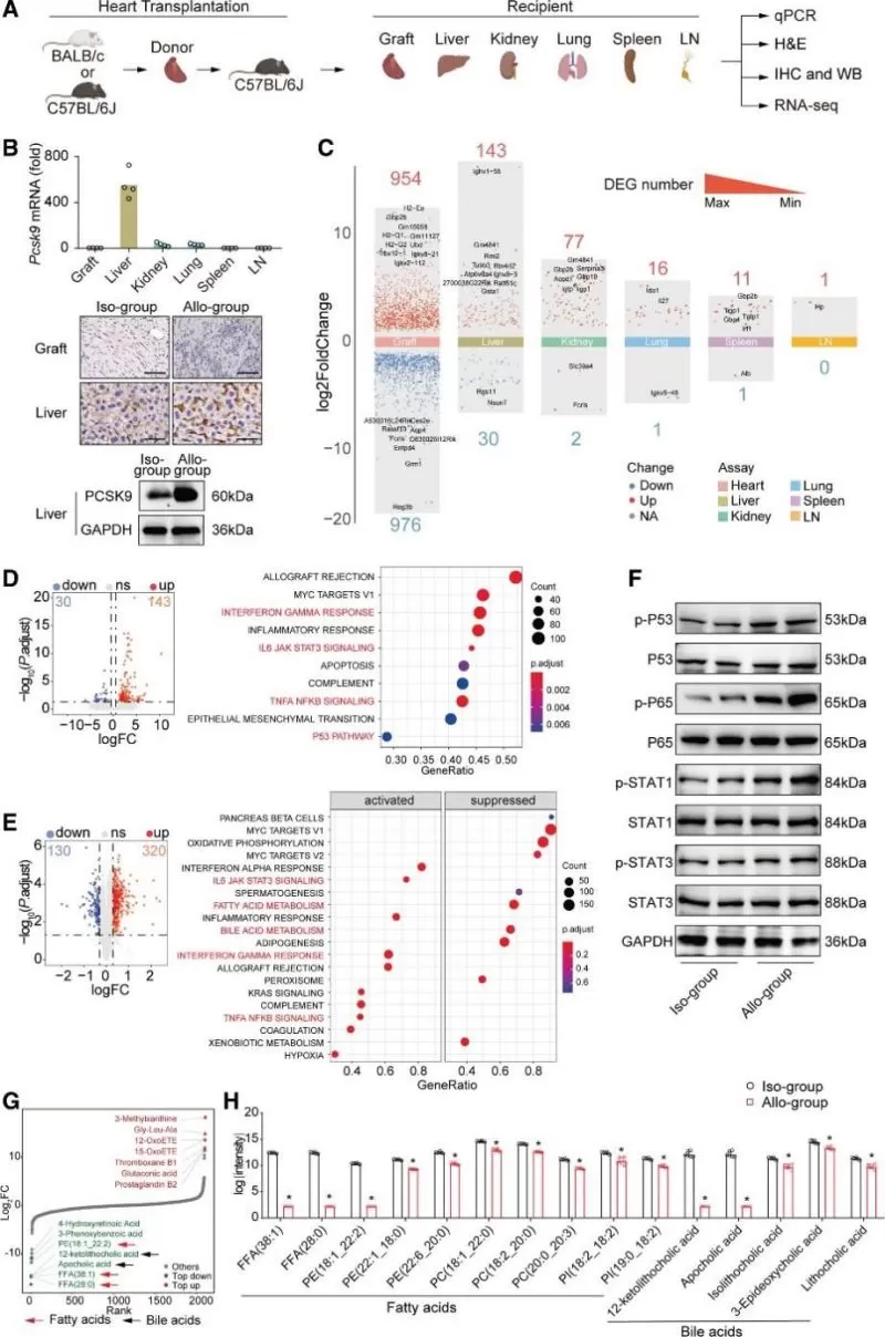 Figure 2. Histological and multiomics analyses of multiple organs in recipients during heart transplant rejection.